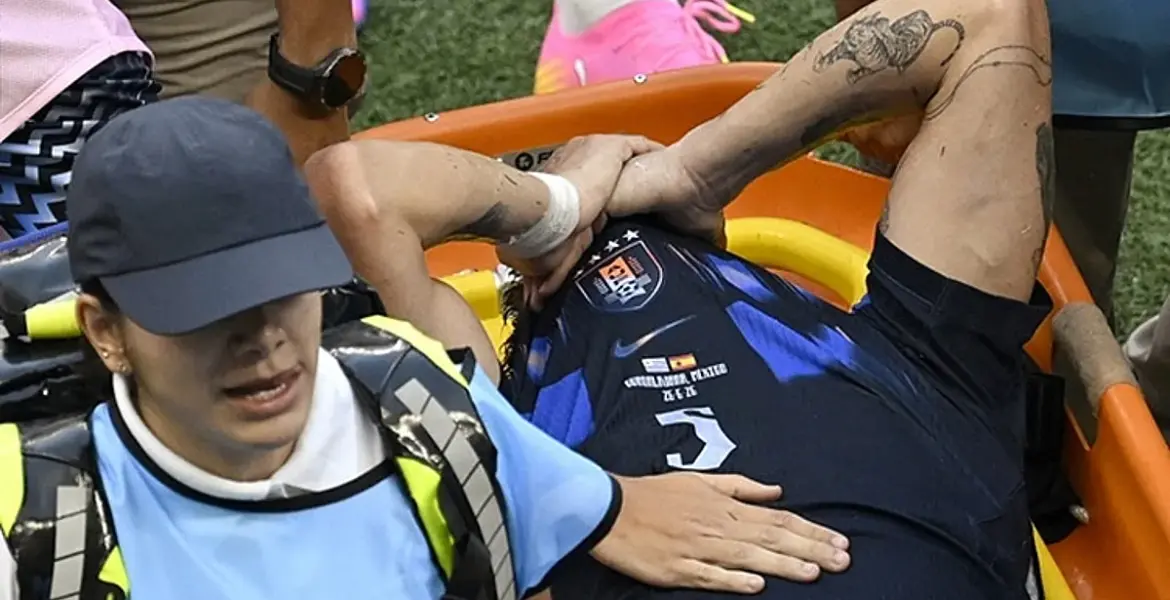 Man Utd Midfielder’s World Cup Exit on Stretcher Sparks Transfer Fears - Sports Illustrated